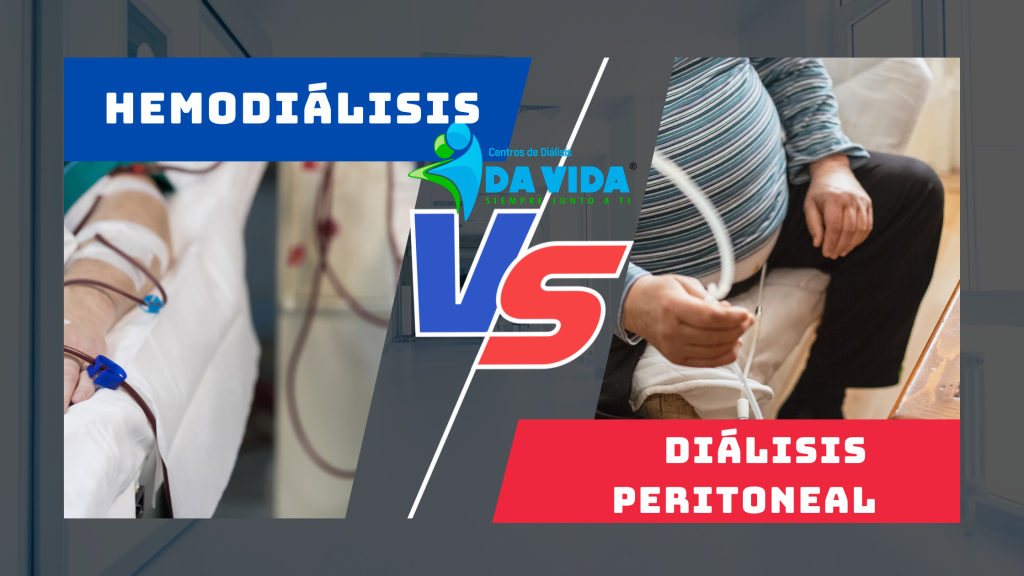 Comparativa de los diferentes tipos de diálisis: pros y contras en el tratamiento de la enfermedad renal