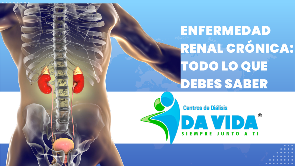 Enfermedad renal crónica: todo lo que debes saber